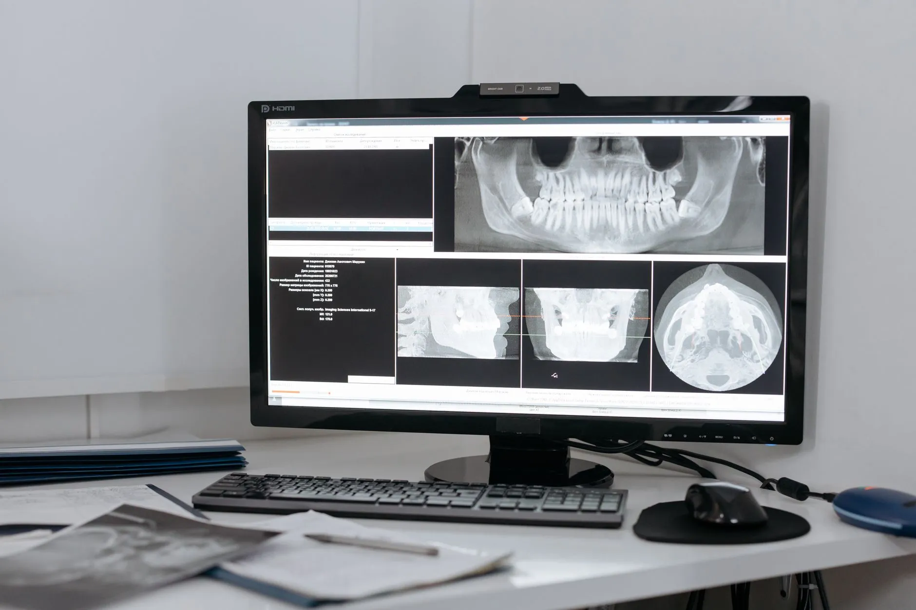 Dentist showing a patient digital X-rays and intraoral camera images on a chairside screen at a dental office in Round Rock, TX