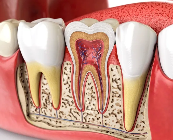 Illustration of a tooth with cleaned and sealed root canals — root canal treatment in Round Rock, TX