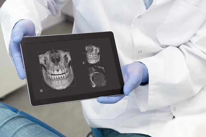 Low-radiation digital X-rays — dental technology in Round Rock, TX