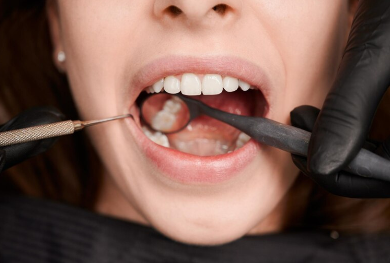 Dental Fillings in Round Rock, TX